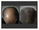 Slider image (6) Giovanni Bojanini | Alopecia Hair Loss Center